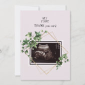 Roze ultrasone foto Dank u Baby Uitzicht Bedankkaart (Voorkant)