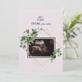 Roze ultrasone foto Dank u Baby Uitzicht Bedankkaart (Staand voorkant)