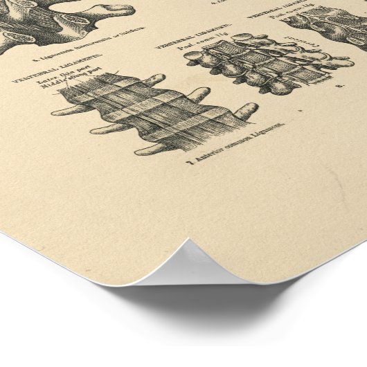  ruggengraat Botten 1880 Afdrukken Poster (Hoek)