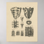  ruggengraat Botten 1880 Afdrukken Poster (Voorkant)