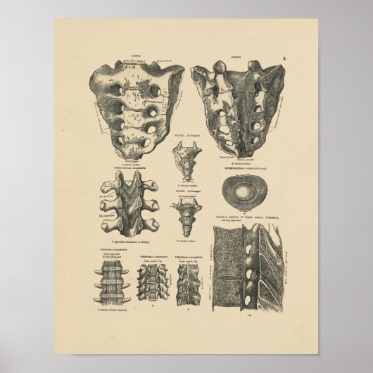  ruggengraat Botten 1880 Afdrukken Poster (Voorkant)