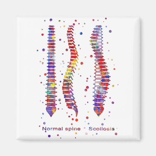 ruggengraat magneet (Voorkant)