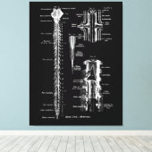 Ruggenmerg Membraan Anatomie Medisch Decor Canvas Afdruk (Insitu (Houten vloer))