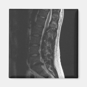 Ruptured Disk Magnet