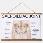 Sacro-iliacaal gewricht hangend wandkleed (Voorkant)