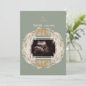 Sage Ultrasound Foto Dank u Baby Punt van Uitzicht Bedankkaart (Staand voorkant)