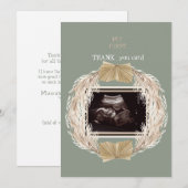 Sage Ultrasound Foto Dank u Baby Punt van Uitzicht Bedankkaart (Voorkant / Achterkant)