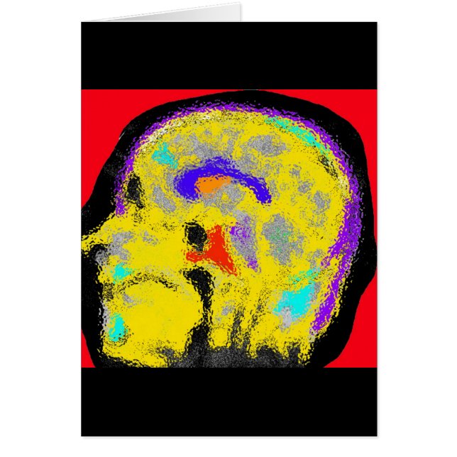 sagital MRI (Voorkant)