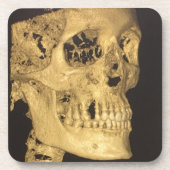 Scale schedel bier onderzetter (Voorkant)