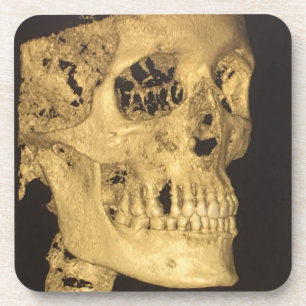 Scale schedel bier onderzetter