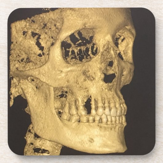 Scale schedel bier onderzetter (Voorkant)