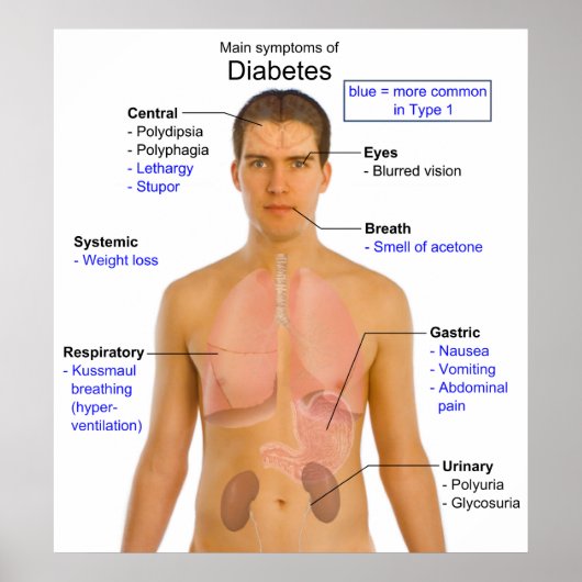 Schema van de voornaamste symptomen van diabetes b poster (Voorkant)