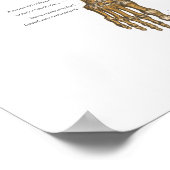 Schema van het skeletsysteem bij mensen met ligame poster (Hoek)