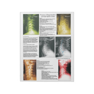 Scheur uit pad Cervical Spinal Degeneration Notitieblok