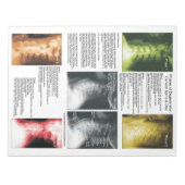 Scheur uit pad Cervical Spinal Degeneration Notitieblok (Voorkant)