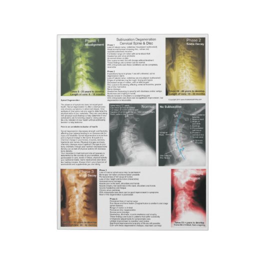 Scheur uit Pad subluxe cervicale degeneratie Notitieblok (Linkerzijde)