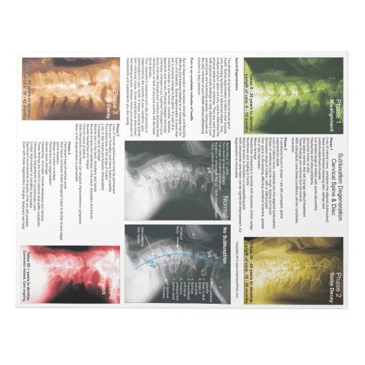 Scheur uit Pad subluxe cervicale degeneratie Notitieblok (Voorkant)