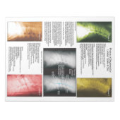 Scheur uit poot Lumbar Spinale degeneratie Notitieblok (Voorkant)