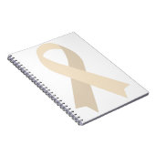 Schijfdegeneratieve schijfziekte met behulp van cr notitieboek (Rechterzijde)