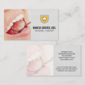 Schone tanden Mondinspectie Visitekaartje (Voorkant / Achterkant)