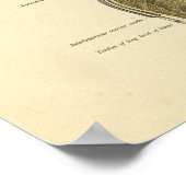 Schouder gezamenlijke ligamenten Anatomie Print (Hoek)