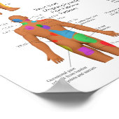Sclerotome Joint Pain Referral Poster Chiropraktij (Hoek)