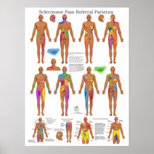 Sclerotome Joint Pain Referral Poster Chiropraktij