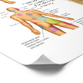 Sclerotome Viscerale Pijn Referentie Poster (Hoek)