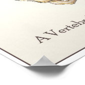 Scoliosis Spine Poster (Hoek)