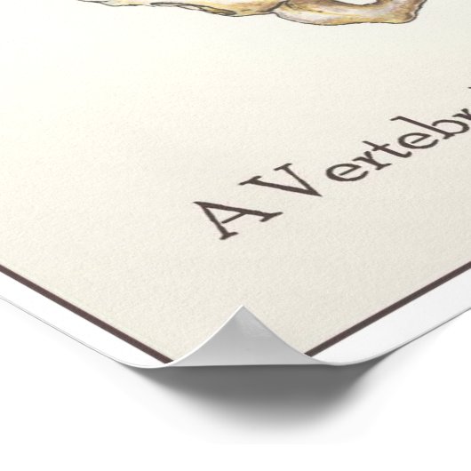 Scoliosis Spine Poster (Hoek)