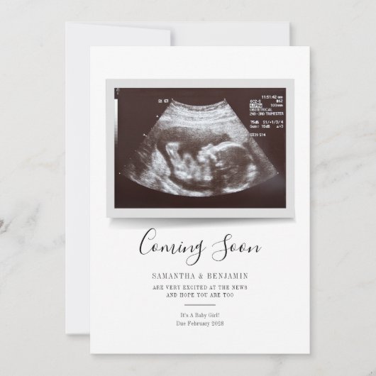 Script Sonogram Komt Erbij Zwangerschapsaankondigi (Voorkant)