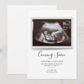 Script Sonogram Komt Erbij Zwangerschapsaankondigi (Voorkant / Achterkant)