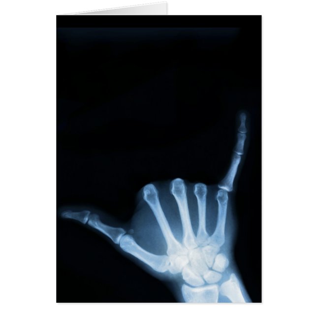 Shaka Sign X-Ray (Hang los) (Voorkant)