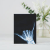 Shaka Sign X-Ray (Hang los) Briefkaart (Staand voorkant)