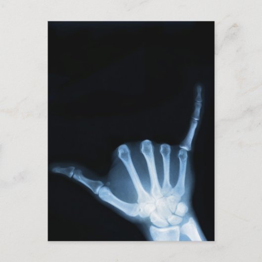 Shaka Sign X-Ray (Hang los) Briefkaart (Voorkant)