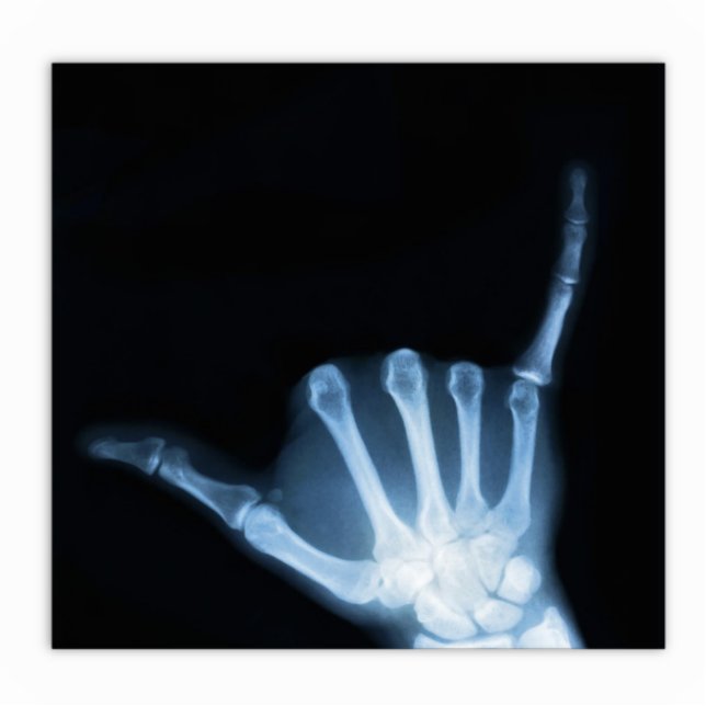 Shaka Sign X-Ray (Hang los) Staand Fotobeeldje (Voorkant)