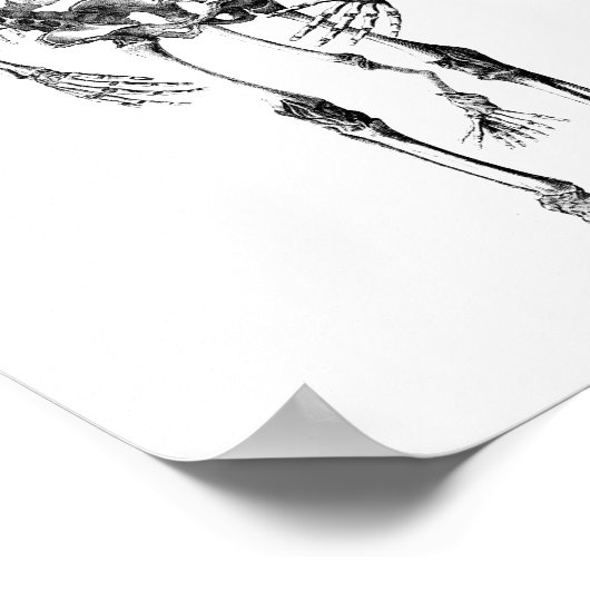 Siamese met tweelingen Anatomie Skeletons kunst Poster (Hoek)