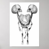 Siamese met tweelingen Anatomie Skeletons kunst Poster (Voorkant)