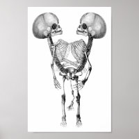 Siamese met tweelingen Anatomie Skeletons kunst