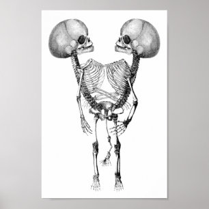 Siamese met tweelingen Anatomie Skeletons kunst Poster