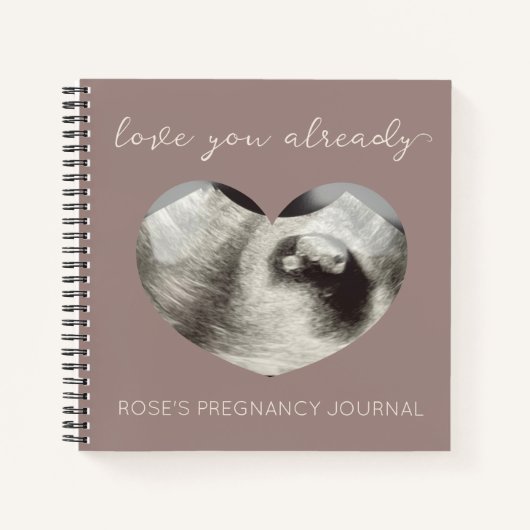 Simple Heart Sonogram Echografie Zwangerschap Jour Notitieboek (Voorkant)