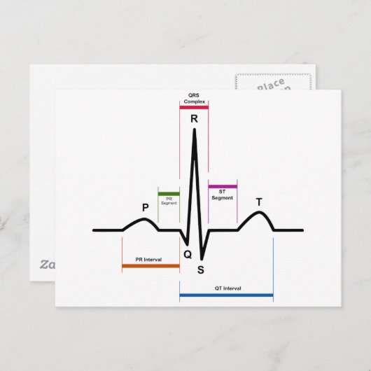 Sinus Rhythm in een ECG-elektrocardiogram diagram Briefkaart (Voorkant / Achterkant)