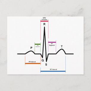 Sinus Rhythm in een ECG-elektrocardiogram diagram Briefkaart