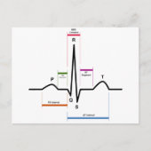 Sinus Rhythm in een ECG-elektrocardiogram diagram Briefkaart (Voorkant)