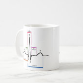 Sinus Rhythm in een ECG-elektrocardiogram diagram Koffiemok (Voorkant links)