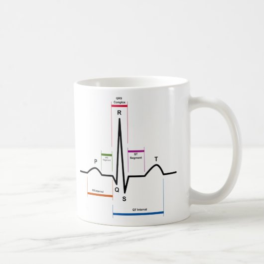 Sinus Rhythm in een ECG-elektrocardiogram diagram Koffiemok (Rechts)