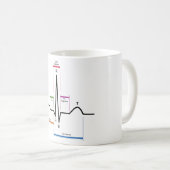 Sinus Rhythm in een ECG-elektrocardiogram diagram Koffiemok (Voorkant rechts)