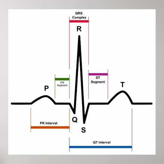 Sinus Rhythm in een ECG-elektrocardiogram diagram Poster (Voorkant)
