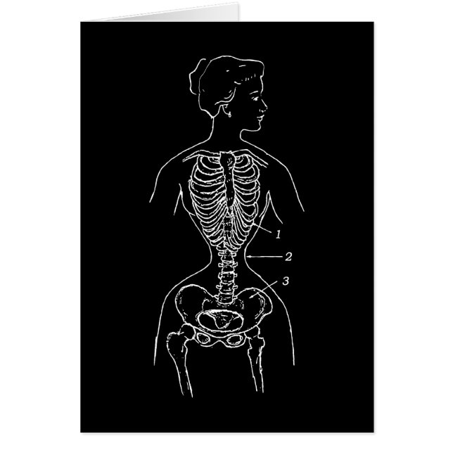 Skelet en corset (Voorkant)