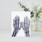 Skelet Handen Xray Afbeelding tekenen Menselijke A Briefkaart (Staand voorkant)